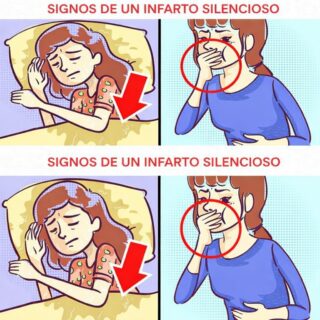 6 señales de un infarto silencioso que todavía se ignoran