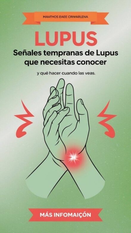 7 síntomas del lupus que debes conocer