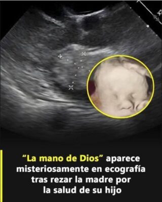 ESTA EMBARAZADA QUERÍA SU SECCIÓN DE FOTOS CON CIENTOS DE ABEJAS EN EL VIENTRE PERO ALGO INESPERADO PASO.