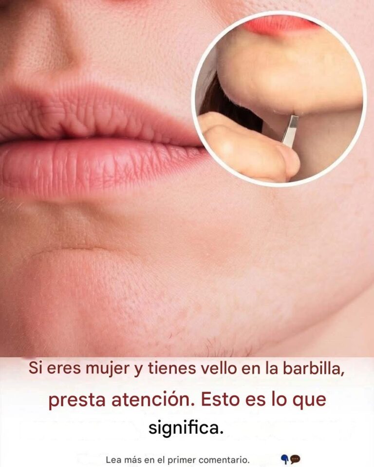 ¿Las mujeres tienen bigote en la barbilla?