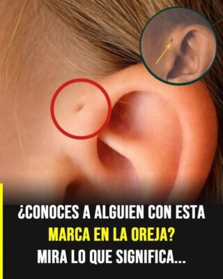 Las personas con este hoyo en la oreja tienen… Ver más