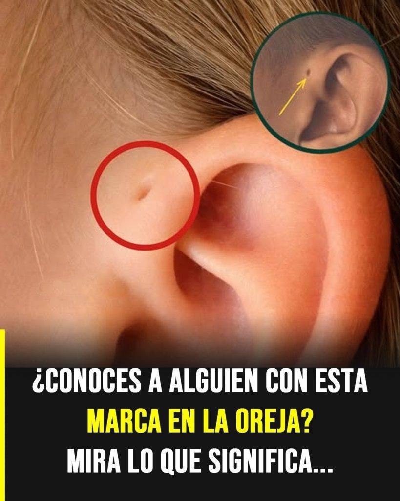Las personas con este hoyo en la oreja tienen… Ver más
